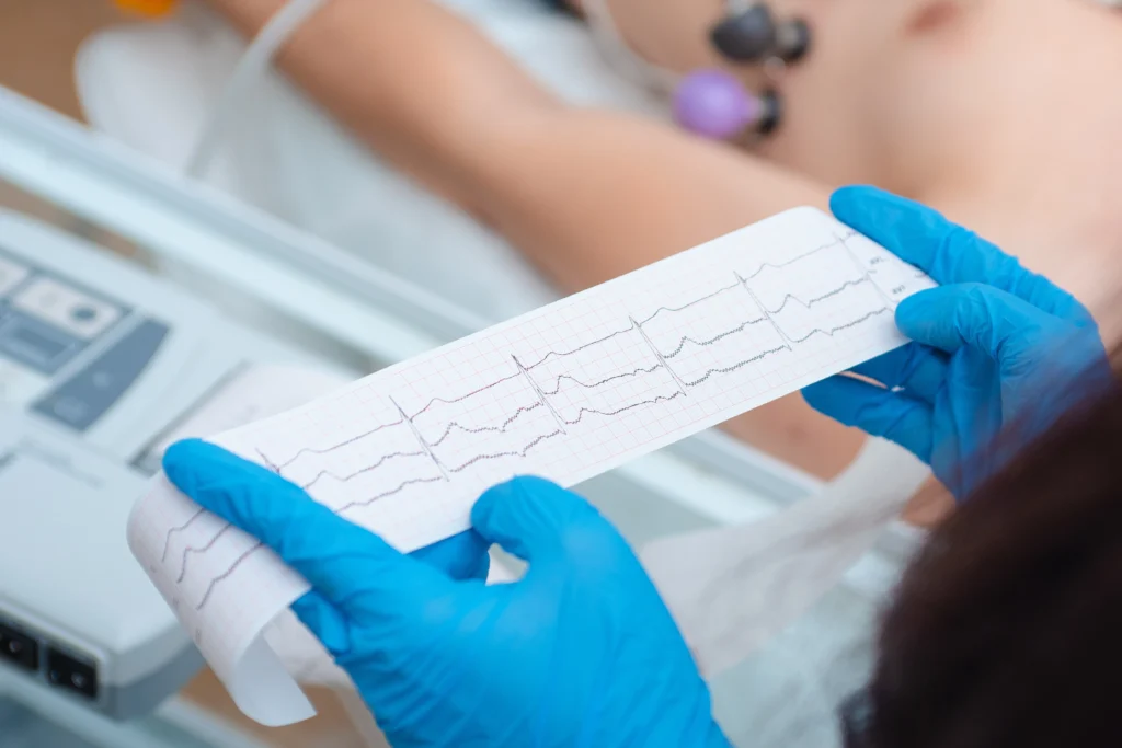 Lékař drží v rukou v modrých rukavicích záznam EKG